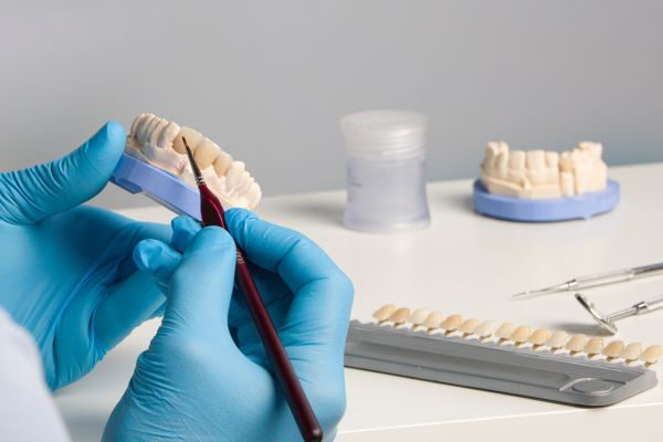 Dental Implants Mould