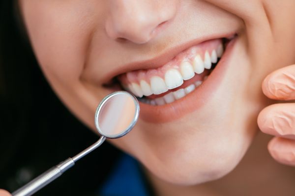 Close up on a woman's smiling face, she is holding a dental mirror. About WV1 Dental & Implant Clinic, Wolverhampton