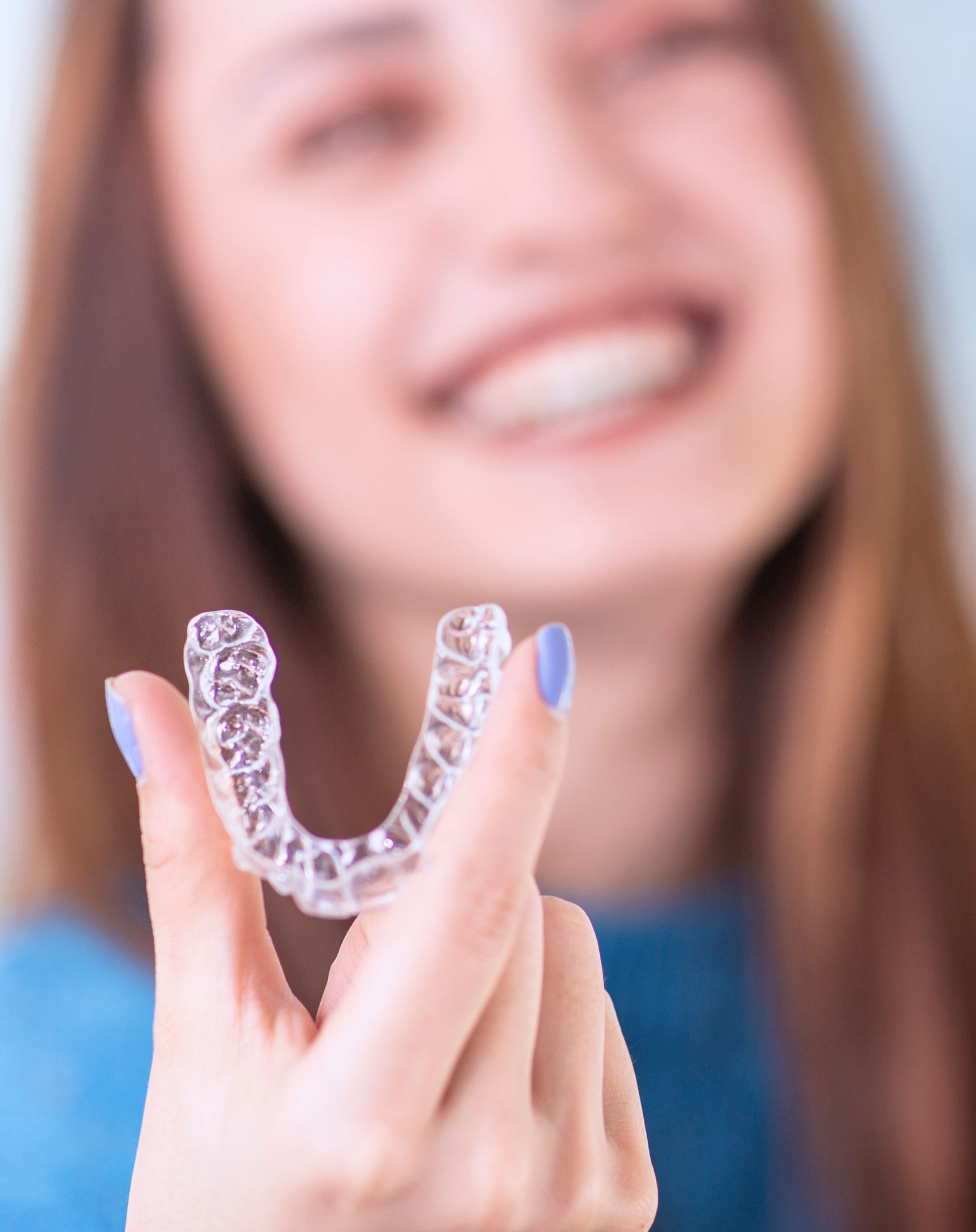 Invisalign aligners